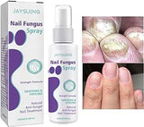 Gentle Nail Fungus Remover