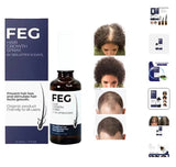 The SOUQ TRENDZ™ FEG Hair Growth Spray