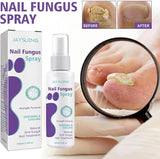 Gentle Nail Fungus Remover
