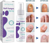 Gentle Nail Fungus Remover